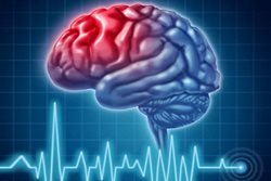 عوارض کرونا بر "بیماری های مغزی" چیست؟