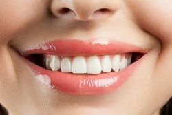 9 راهی که باعث می شوند ناخواسته دندان هایتان را لک کنید