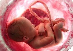 آیا کرونا باعث سقط جنین می شود؟