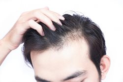 ویروس کرونا چند روز بر روی موی سر فعال است؟