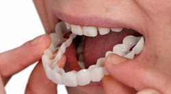 پروتز دندان باید به صورت مرتب ضدعفونی شود