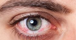 به تعویق انداختن درمان کدام یک از بیماری های چشمی خطرناک است؟