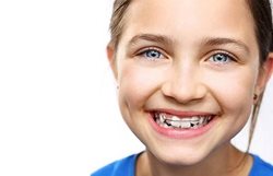هر آنچه لازم است در مورد ارتودنسی دندان کودک بدانید