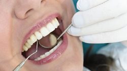 کشف یک شیرینی جدید برای تقویت و سفیدی دندان ها