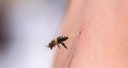 درمان روماتیسم با نیش زنبور در مصر + عکسها