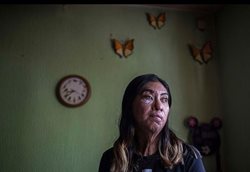 بازماندگان حملات اسیدپاشی در مکزیک + تصاویر
