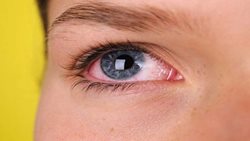عوارض چشمی کرونا از خود کرونا بدتر هستند