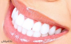 90% تخفیف خدمات متنوع دندانپزشکی در مطب دکتر کشاورز