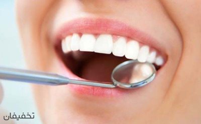 90% تخفیف خدمات متنوع دندانپزشکی در مطب دکتر کشاورز