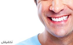 80% تخفیف  بلیچینگ و سفید کردن دندان در مطب دندانپزشکی دکتر مرادی