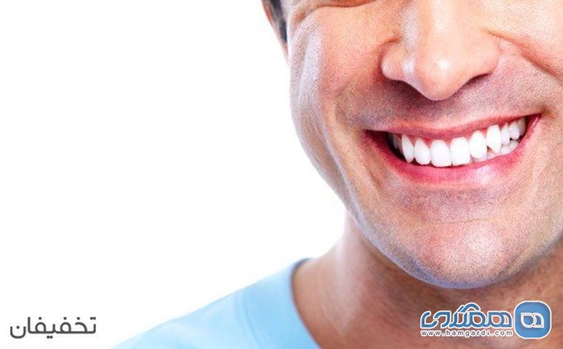80% تخفیف  بلیچینگ و سفید کردن دندان در مطب دندانپزشکی دکتر مرادی