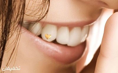 92% تخفیف کاشت نگین دندان در مطب دندان پزشکی دکتر علیزاده به همراه نگین ساده رایگان