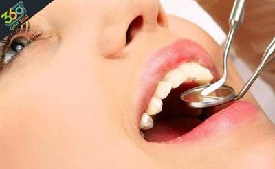 تهران-دندانهایی-سفید-و-زیبا-با-بلیچینگ-دندان-در-کلینیک-دندانپزشکی-دکتر-طایی-با-84-تخفیف-61288