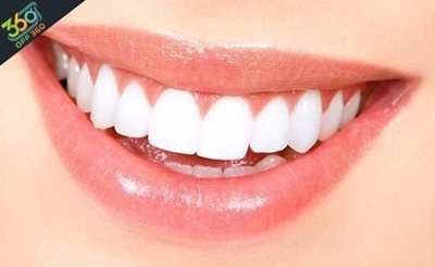 تهران-دندانهایی-سفید-و-زیبا-با-بلیچینگ-دندان-در-کلینیک-دندانپزشکی-دکتر-طایی-با-84-تخفیف-61292