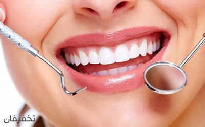 90% تخفیف طراحی لبخند هالیوودی، اصلاح طرح لبخند و خدمات متنوع در مطب دندانپزشکی دکتر علیزاده