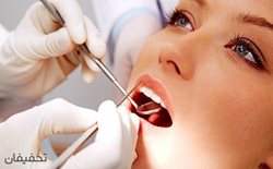 83% تخفیف خدمات جرم گیری، کشیدن، پر کردن و بلیچینگ دندان در در دندانپزشکی اشراقی