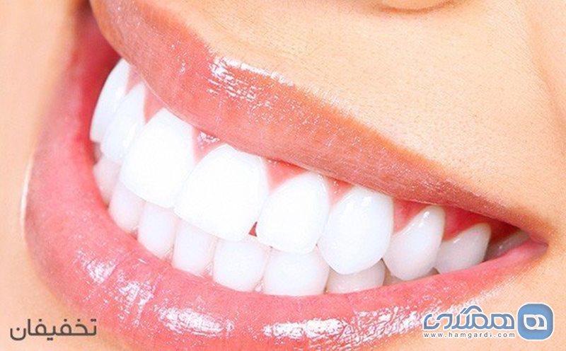 88% تخفیف جرمگیری دندان در مطب دندانپزشکی دکتر مرادی