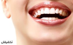 58% تخفیف کامپوزیت ونیر دندان کلینیک دندانپزشکی جام جم