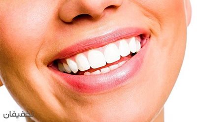66% تخفیف خدمات متنوع زیبایی دندان در دندانپزشکی لبخند سفید