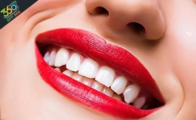 دندانهایی زیبا و جذاب  درکلینیک دندانپزشکی دکتر مهماندوست