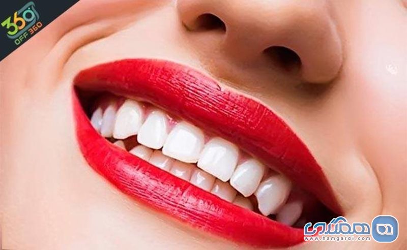 دندانهایی زیبا و جذاب  درکلینیک دندانپزشکی دکتر مهماندوست
