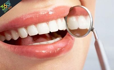 تهران-خدمات-مختلف-دندان-عصب-کشی-پر-کردن-کشیدن-در-کلینیک-دندانپزشکی-لبخند-زیبا-75751