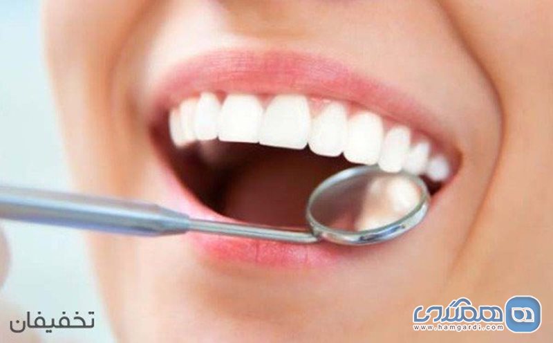 90% تخفیف خدمات متنوع در دندانپزشکی لبخند سفید