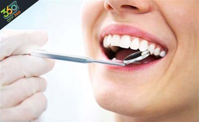 تهران-دندان-هایی-سفید-و-زیبا-با-جرم-گیری-و-بروساژ-در-کلینیک-دندانپزشکی-لبخند-زیبا-83224