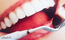 90% تخفیف انواع خدمات دندانپزشکی در کلینیک دندانپزشکی هامون