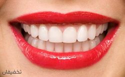 80% تخفیف خدمات متنوع دندان در مرکز دندانپزشکی نیکنام