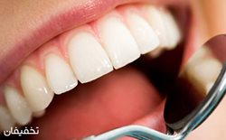 86% تخفیف خدمات متنوع دندانپزشکی در مطب مریم ودادمفرد
