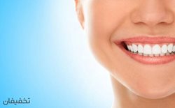90% تخفیف مرکز دندانپزشکی زیبایی مدرن اشرفی کلیه خدمات
