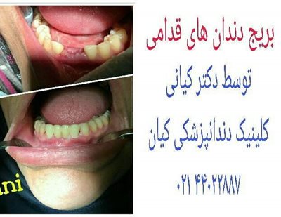 تهران-کلینیک-دندانپزشکی-کیان-292834