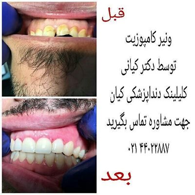 تهران-کلینیک-دندانپزشکی-کیان-292848
