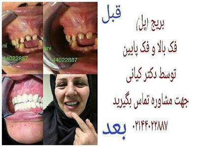 تهران-کلینیک-دندانپزشکی-کیان-292847