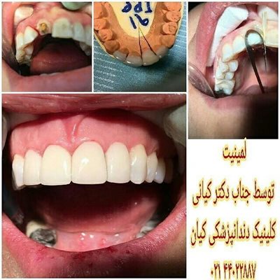 کلینیک دندانپزشکی کیان