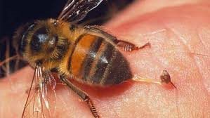 نیش زنبور و درمان آرتروز