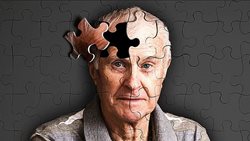 راه هایی برای کاهش خطر ابتلا به بیماری آلزایمر