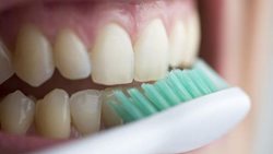 پیشگیری از زرد شدن دندان با روشهای خانگی و طبیعی