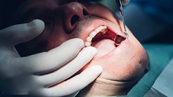 هشدار سازمان جهانی بهداشت درباره مراجعه به دندانپزشکی در روزهای کرونایی