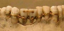 سیم کشی دندان مردگان در مصر باستان + تصویر