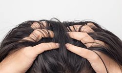 از علت تا درمان درد پوست سر هنگام حرکت مو