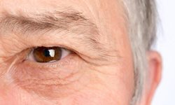 علائم خشکی چشم و روشهای درمان