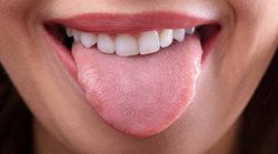 چرا باید زبان خود را تمیز کنیم؟