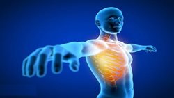 رایج ترین دلایل بروز درد در ناحیه دنده ها