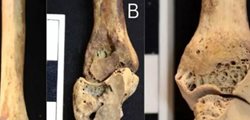 نگاهی به نتایج مطالعه روی استخوانهای اسکلت 3500 ساله یک زن