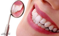 82% تخفیف بلیچینگ یا جرم گیری دندان در مطب دندانپزشکی خانم دکتر ابراهیمی