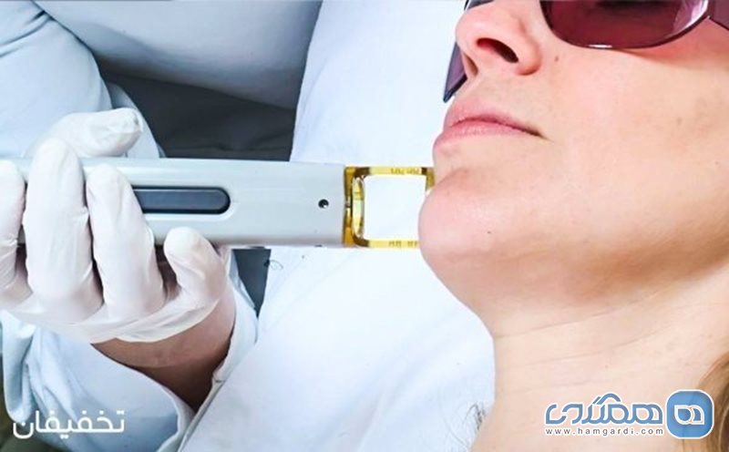 92% تخفیف لیزر موهای زائد Elight در گروه پزشکی سحر