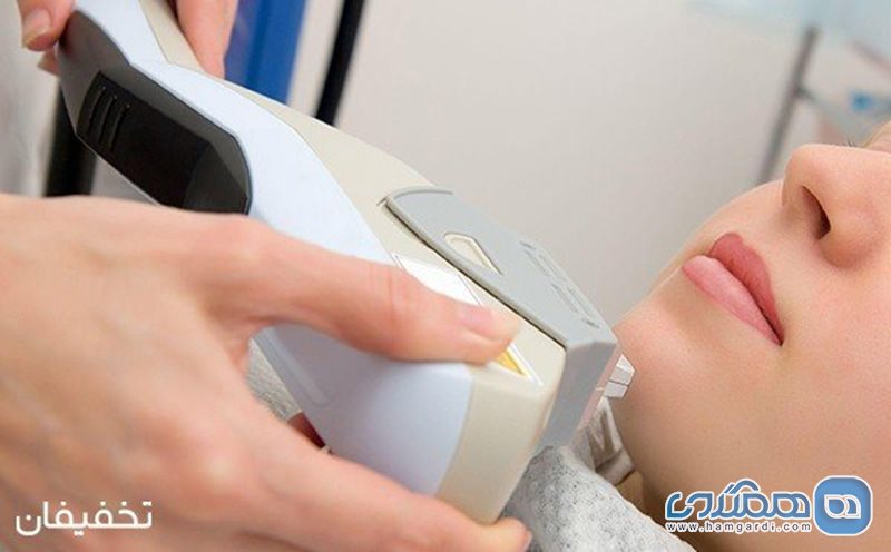 96% تخفیف  برای لیزر موهای زائد  shr (Ipl Star) در کلینیک آفتاب