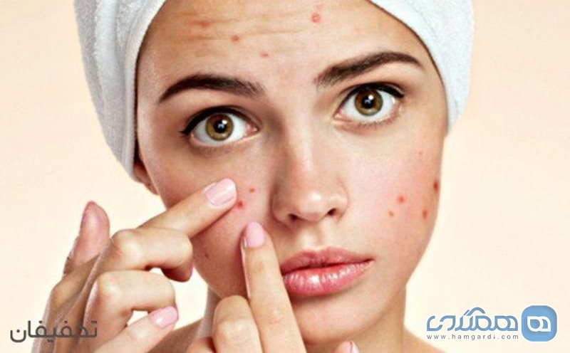 90% تخفیف لیزر رفع جای جوش و لک با دستگاه clear light در مطب دکتر محمدی